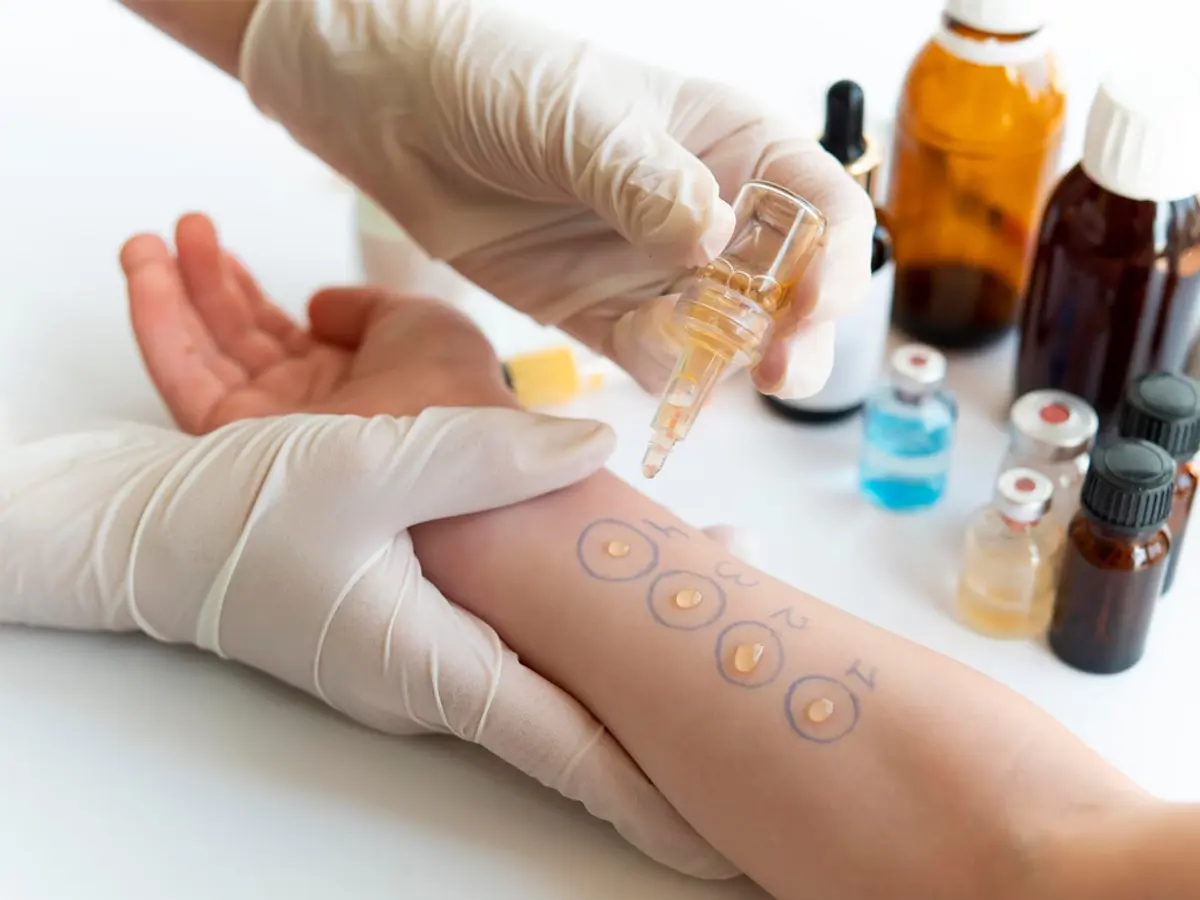 Allergologia — Polispecialistico Medical Life, Muggiò